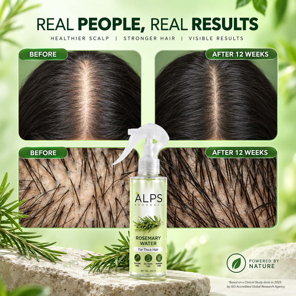 Alps Rosemary Hair Spray – Stronger & Healthier Hair